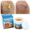 Sumifun - Nail Fungus Ointment