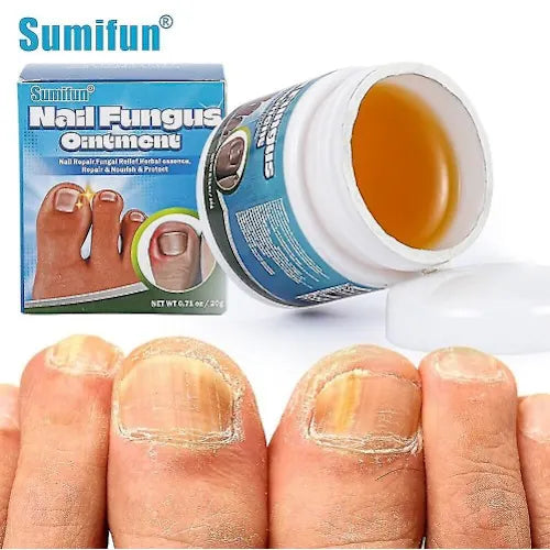 Sumifun - Nail Fungus Ointment