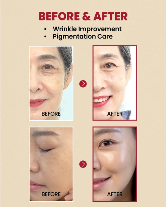 SEOUL 1988 Cream: Retinal Liposome 1% + Fermented Rice