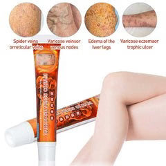 Sumifun - Varicose Veins Cream (Original)