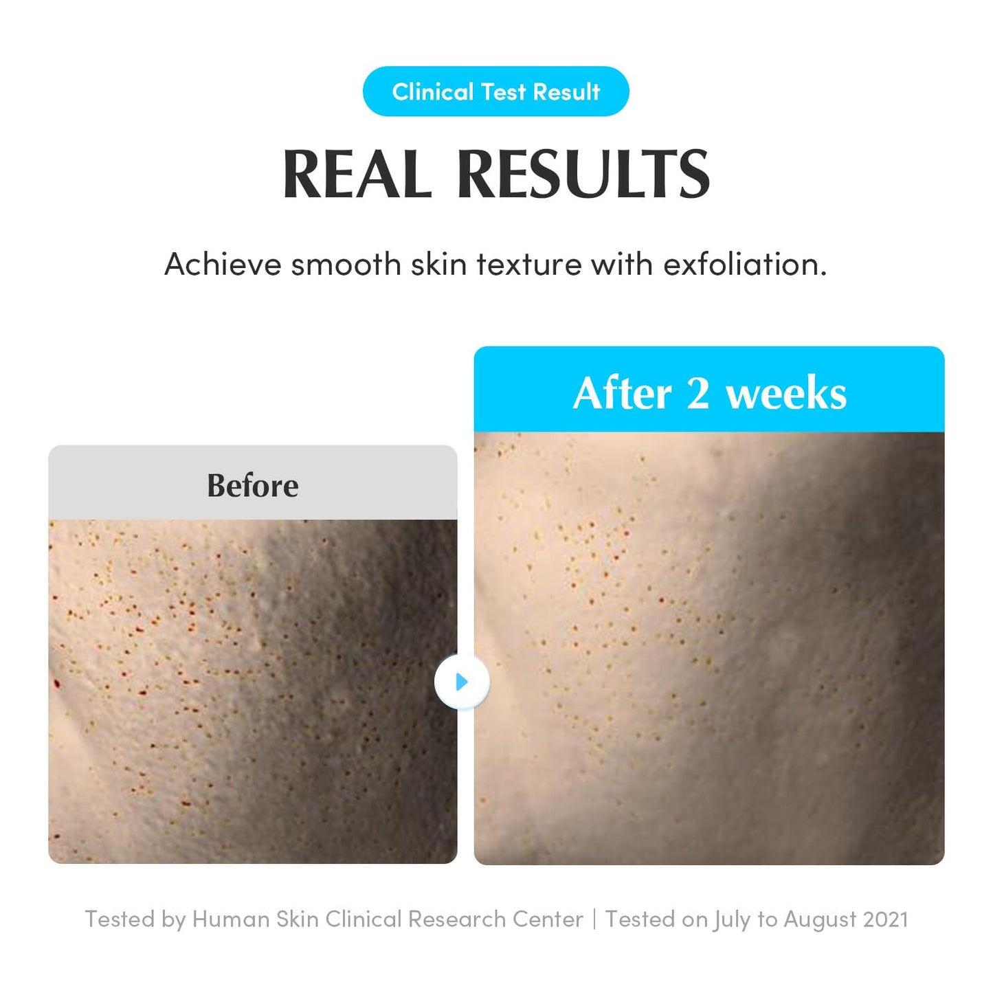 Swimming Pool Toner (Original)