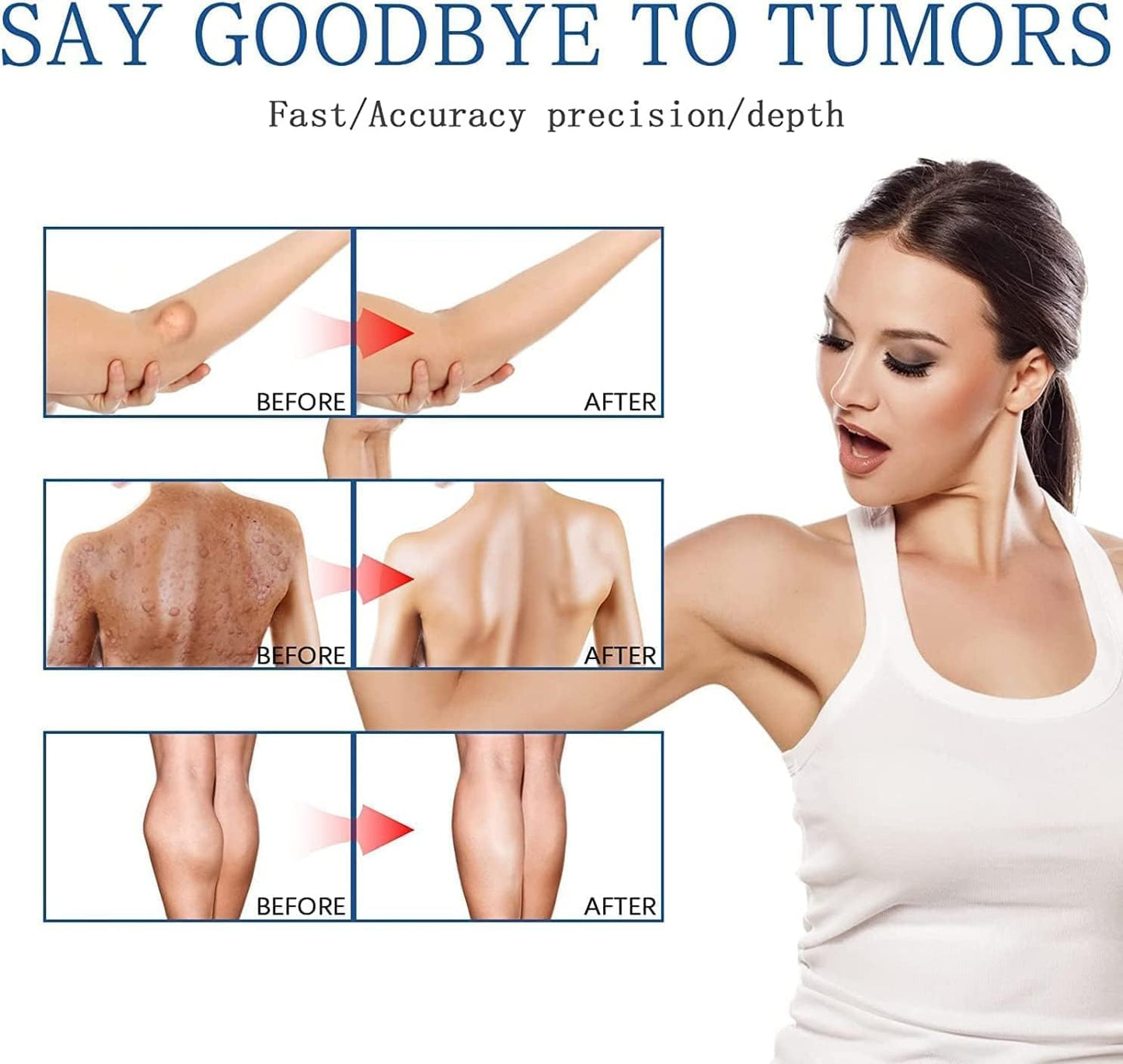 South Moon - Lipoma Removal Spray