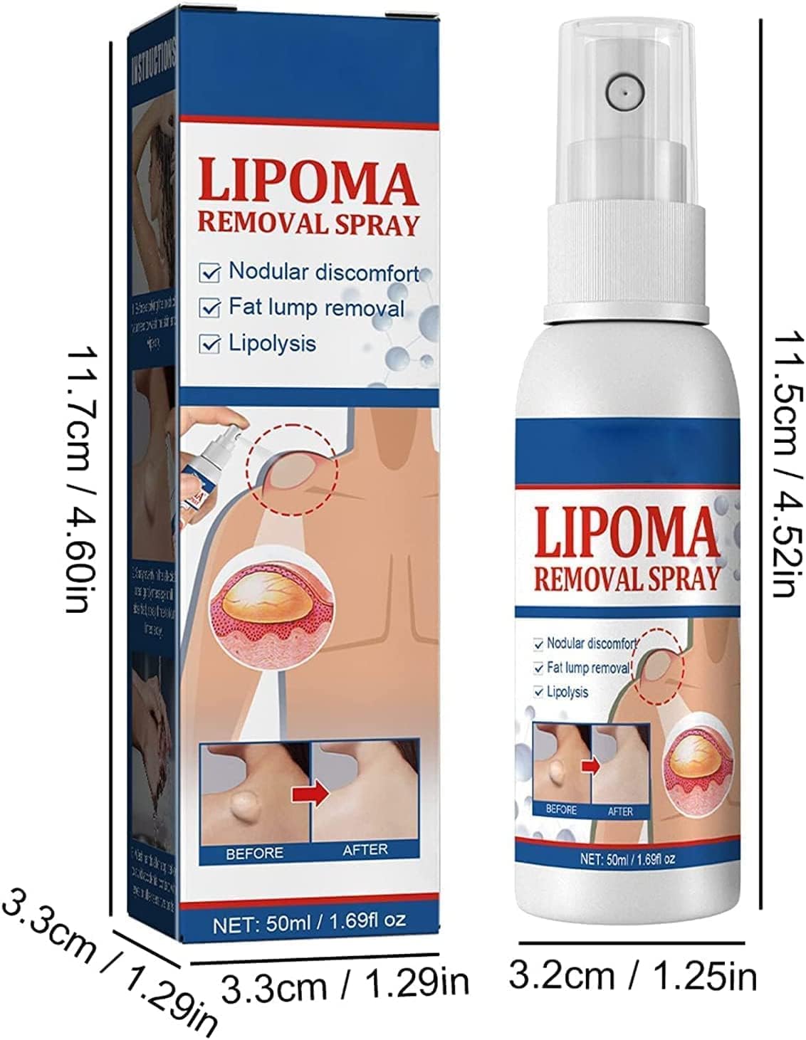 South Moon - Lipoma Removal Spray