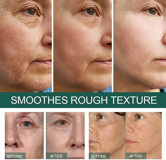 Eelhoe - Dark Spot Correcting Serum (Original)