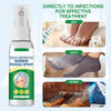 Hand Ringworm Beriberi Fungus Spray