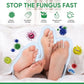 Hand Ringworm Beriberi Fungus Spray