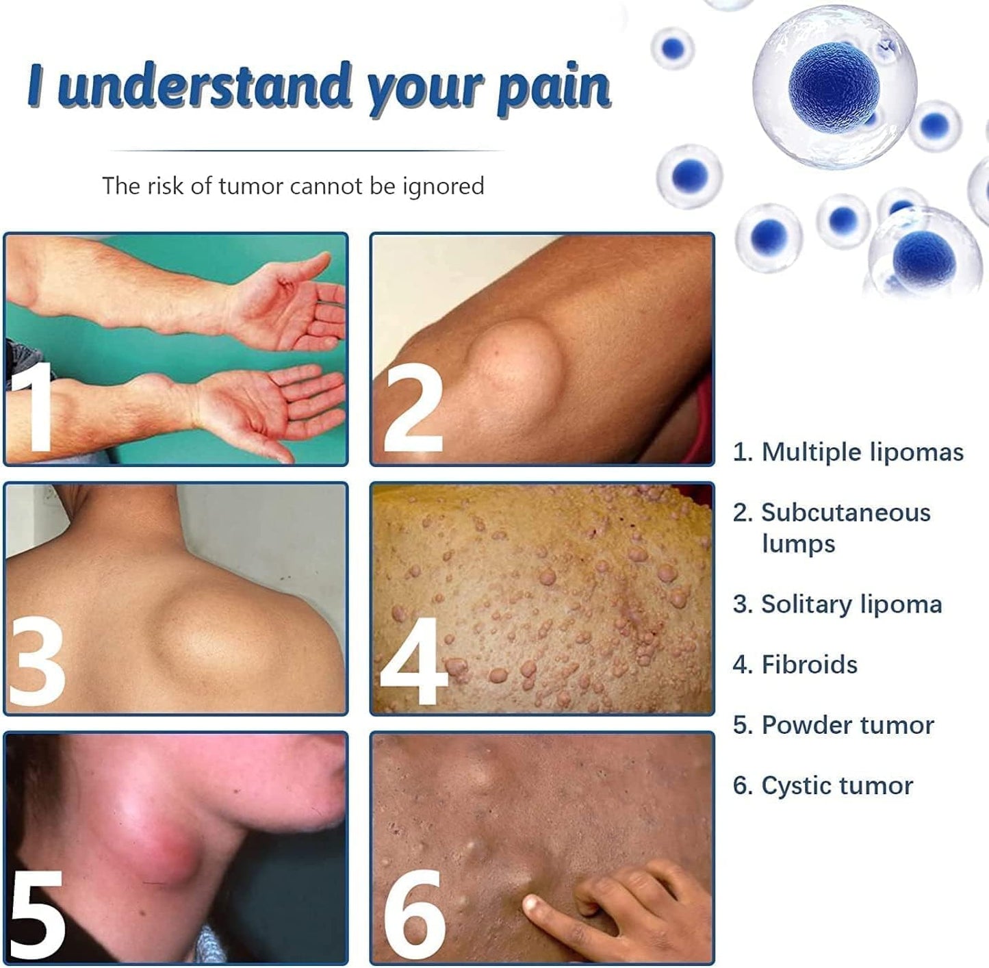 South Moon - Lipoma Removal Spray