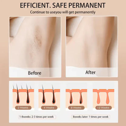 Babyverse - Digital IPL Hair Removal Device