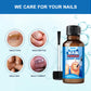 Nail Fungus Treatment Liquid