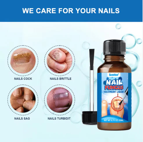 Nail Fungus Treatment Liquid