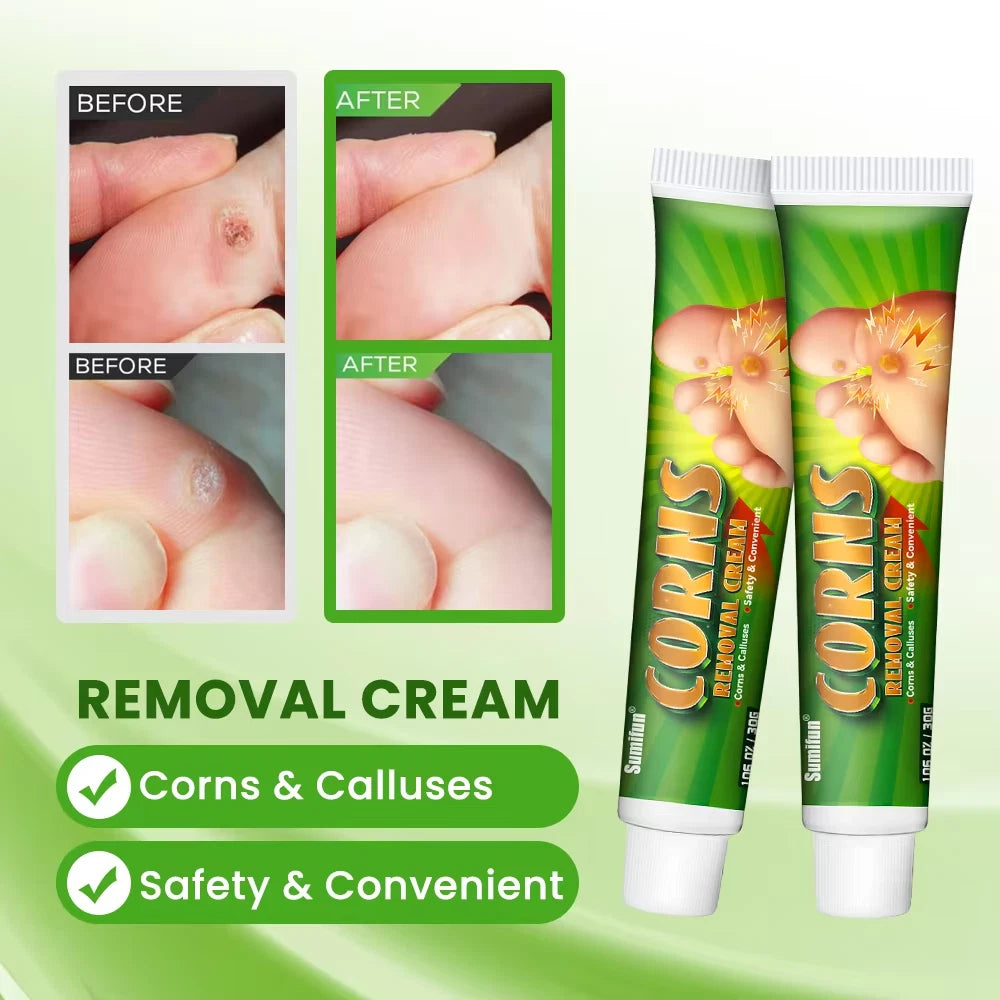 Sumifun - Corns Removal Cream